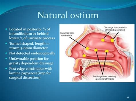 Disorders of Maxillary Sinus