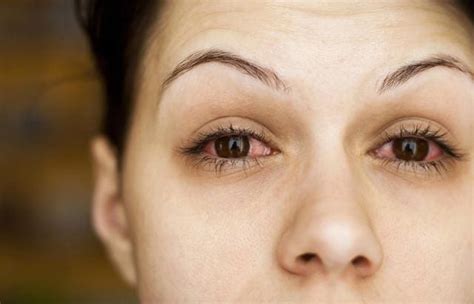 15 things your eyes, hair and skin could be trying to reveal about your health | Health ...