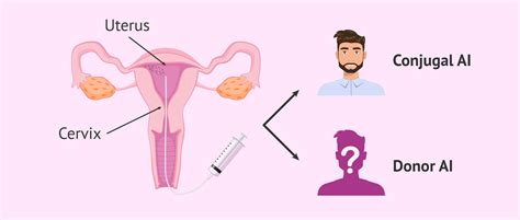 What are the advantages & disadvantages of artifical insemination?