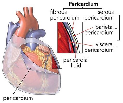 Pericardial window surgery procedure, indications, complications & recovery