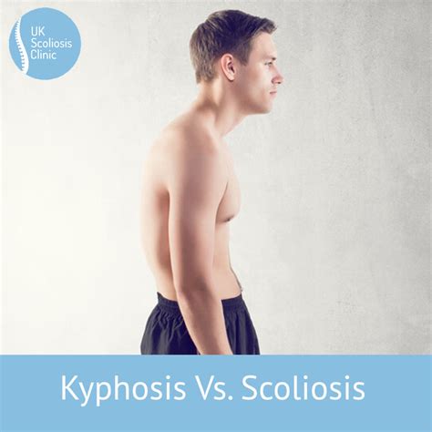 Kyphoscoliosis Causes Symptoms And Treatment