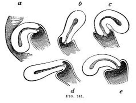 Displacement of the uterus and what is the retroversion and retroflexion? - Biyani School of Nursing