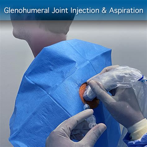 Glenohumeral Joint Injection & Aspiration: Procedure Module – SonoSim