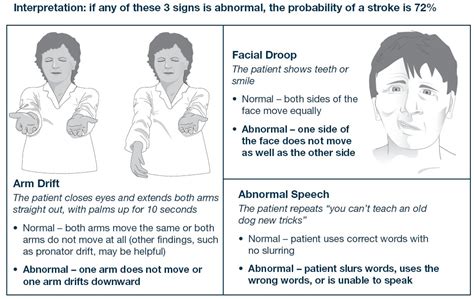 What Is A Cincinnati Stroke Scale Assessment at Grant Parker blog