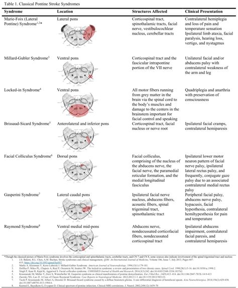 [Figure, Classical Pontine Stroke Syndromes. Contributed by Destiny ...