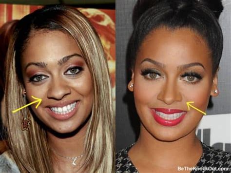 Lala Anthony Plastic Surgery Comparison Photos