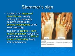 Lymphedema an overview | PPT