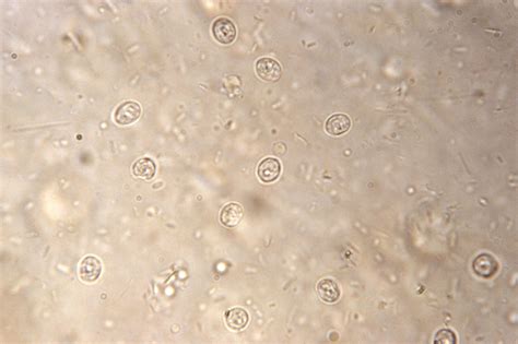 Cryptosporidium Parvum Microscope