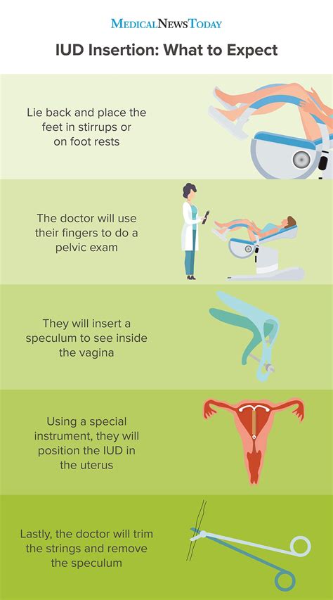 IUD insertion: A guide and what to expect