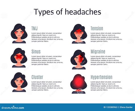 Headache Types. Headaches Areas Infographic Diagram Medical Poster, Brain Pain Type In Head ...