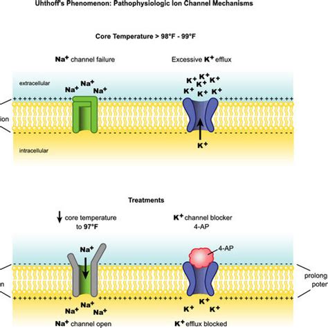 Ion channel pathophysiology in MS. pathophysiological mechanisms of ...