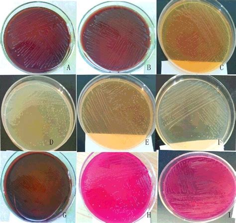 Growth of bacteria on different media and colony morphology following... | Download Scientific ...