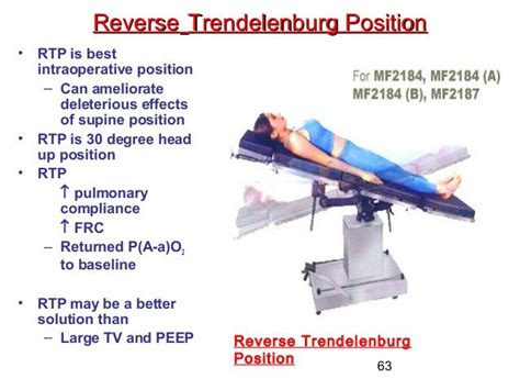 Trendelenburg Position Picture