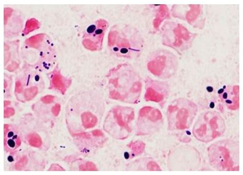 Sputum Gram Stain Epithelial Cells