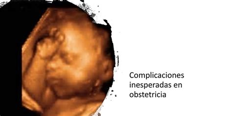 Complicaciones inesperadas en obstetricia. Cómo actuar - Arydol