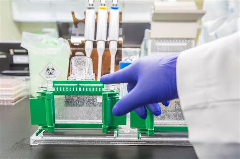 Premium Photo | Western blot analysis or protein analysis