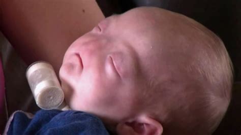 Alabama baby born without nose is 'perfect' - ABC7 San Francisco