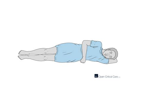 Left Lateral Recumbency position - Open Critical Care