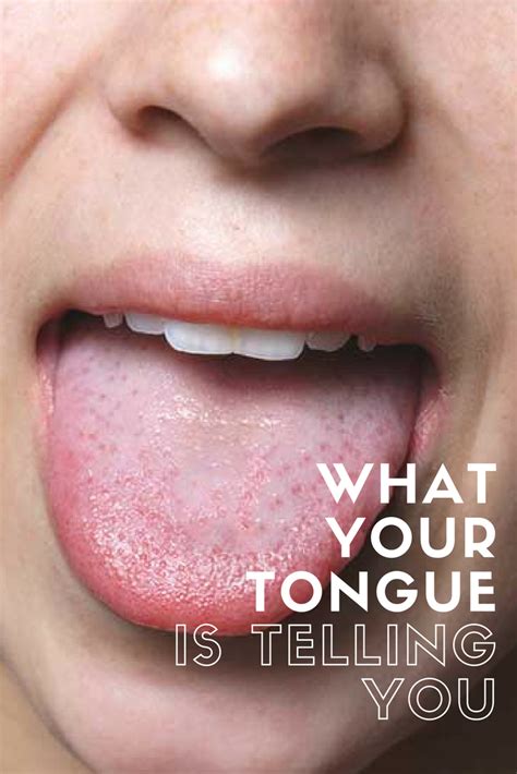 Your tongue could be telling you something | Tongue health, Dental implants, Oral health