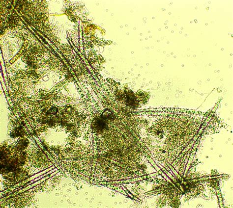 Phycokey - Sponge_spicules