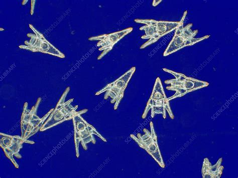 Sea urchin larvae, light micrograph - Stock Image - Z555/0077 - Science ...