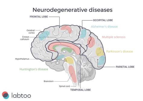 Neurodegenerative disorders: Research and Therapies