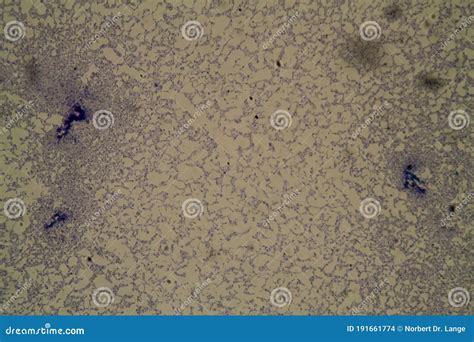 Salmonella pathogen 200x stock photo. Image of microscopy - 191661774