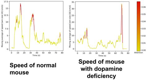 AI Reveals Walking Patterns of Movement Disorders Shared Among Worms ...