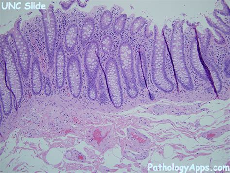 normal large intestine histology