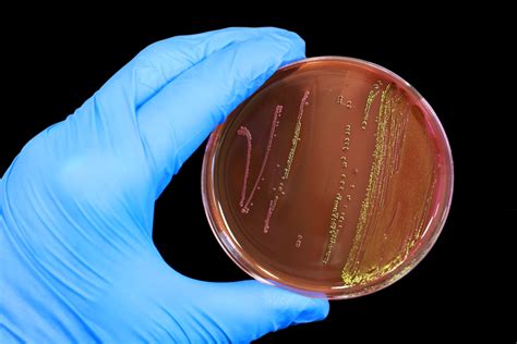 Free photo: Escherichia coli - Analysis, Microbial, Inspection - Free ...