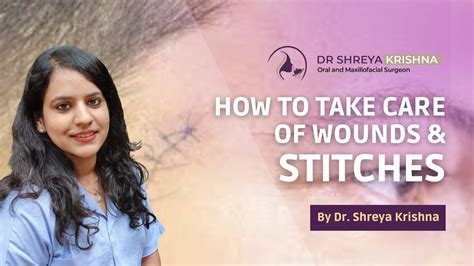 How To Care For Face Wounds and Stitches | Face Stitches Healing ...