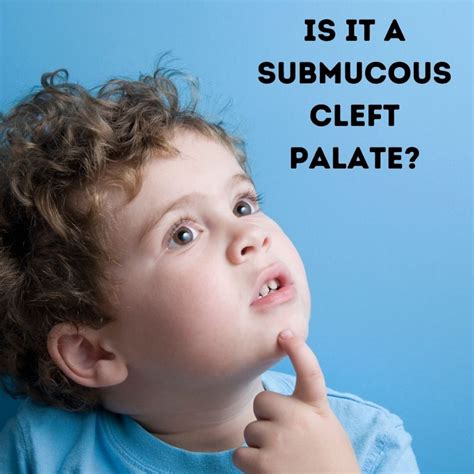 Does my child have a submucous cleft palate? - Verboso