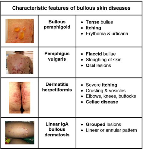 Petechiae pictures causes symptoms diagnosis and treatment updated in ...