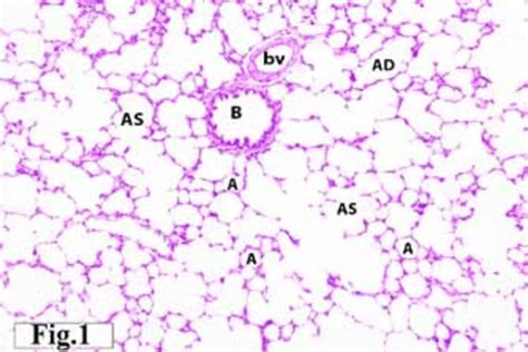 Alveolar Duct And Sac Histology