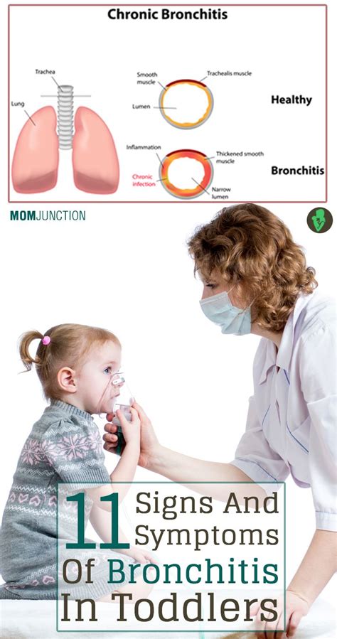 11 Serious Signs And Symptoms Of Bronchitis In Toddlers | Bronchitis symptoms, Asthma kids ...