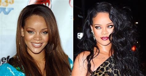 Rihanna claps back at fan who throws shade about her forehead | Metro News