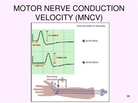 PPT - ELECTROMYOGRAPHY AND MOTOR NERVE CONDUCTION VELOCITY PowerPoint ...