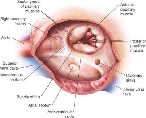 Tricuspid Valve Repair and Replacement | Thoracic Key