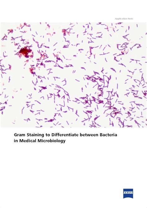 Gram Staining in Medical Microbiology - Scientific Technology News