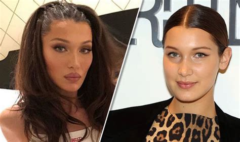 Bella Hadid before and after: Has she had surgery? An expert weighs in ...