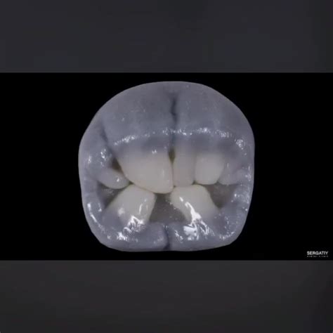 Occlusal Morphology of Composite restoration | By El.Dentist