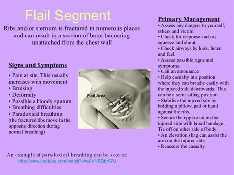 flail chest injury | Icu nursing, Flail chest, Nursing school studying