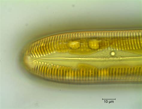 Pinnularia | Diatom Flora of Britain and Ireland