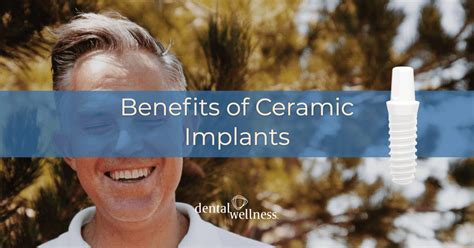 Benefits of Ceramic Implants - Dental Wellness