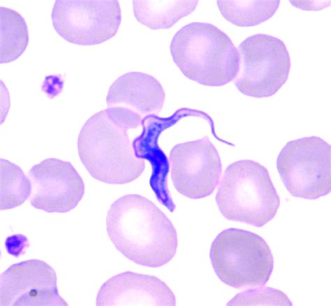 [Solved] 1 Trypanosoma brucei gambiense 2 Trypanosoma cruzi 3 leishmania... | Course Hero