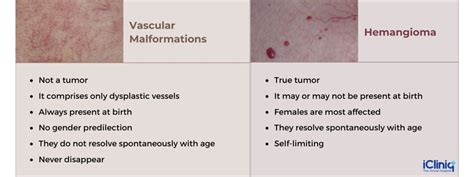 What Is Hemangioma?