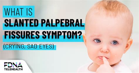 Down slanting palpebral fissures: overview & causes