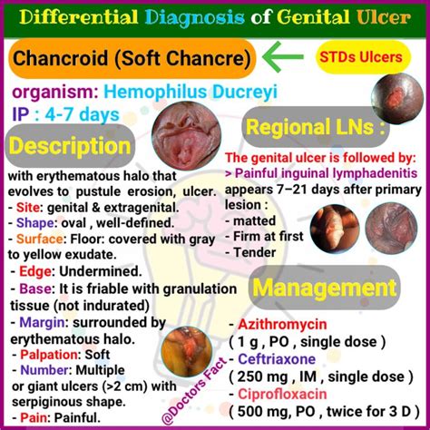 Chancroid (differential Diagnosis of Genital Ulcers ) | Ulcers ...