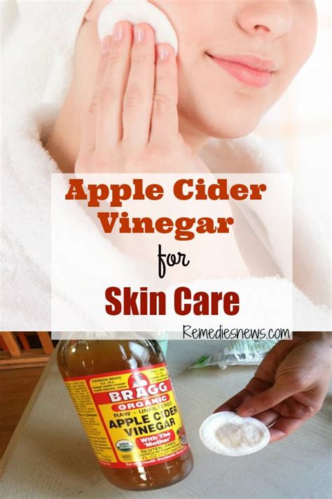 21 Amazing Apple Cider Vinegar Uses and Benefits | Remediesnews