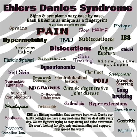 Ehlers-Danlos Syndrome symptoms | Ehlers Danlos Syndrome | Pinterest